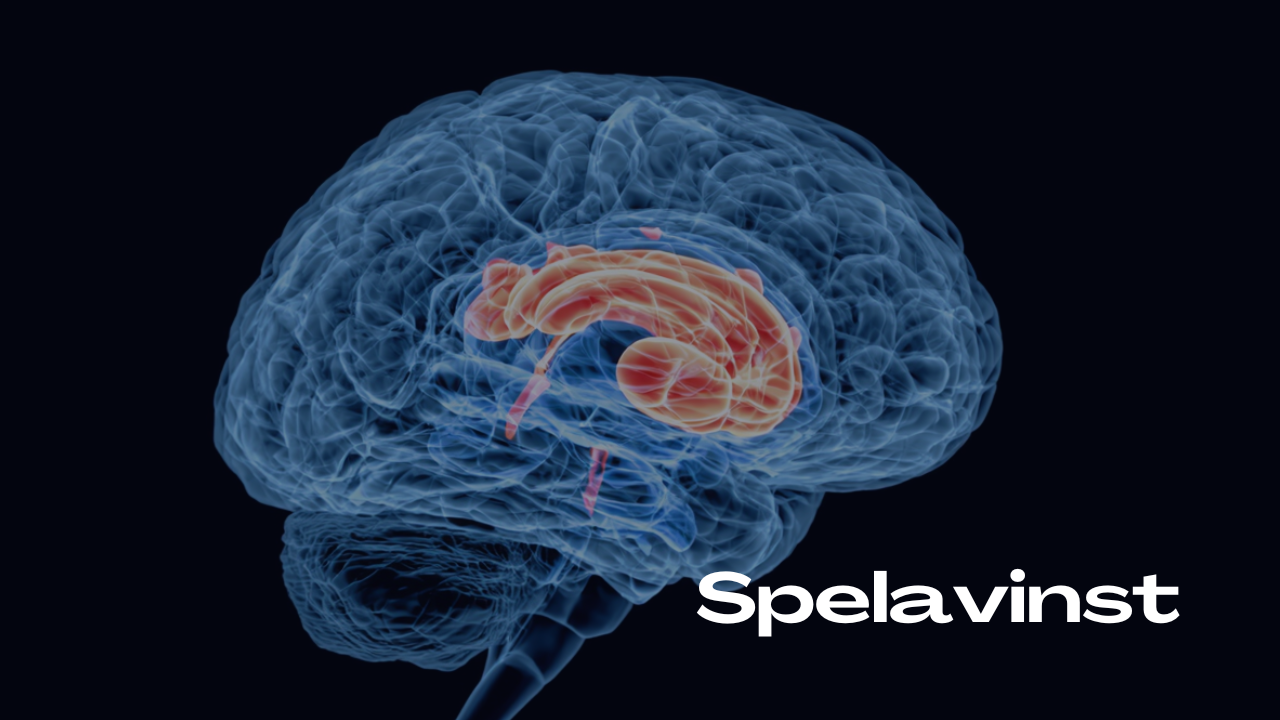 spelavinst-Hjärnscanning spelavinst-Hjärnscanning