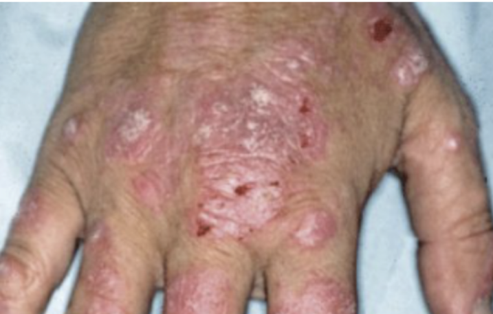 upptäck varför irritation är en drivkraft för utveckling och framgång. jansson förklarar hur nödvändiga känslor formar våra liv och leder till positiva förändringar.